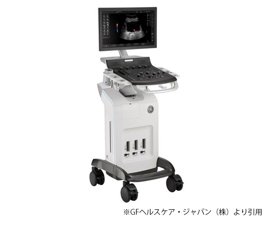 超音波エコー検査